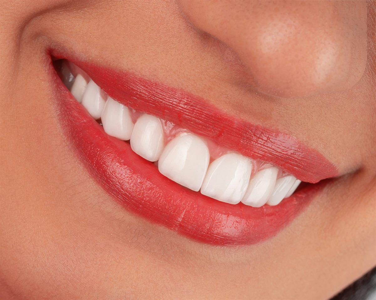 Estética do sorriso - atendimento da Dra. Raíssa Santanna