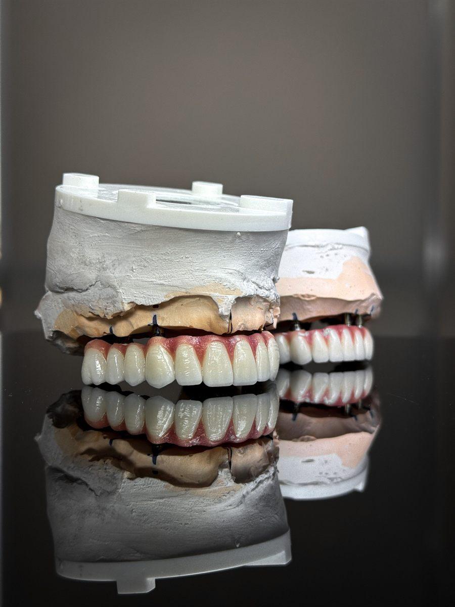 Próteses dentárias - atendimento da Dra. Raíssa Santanna